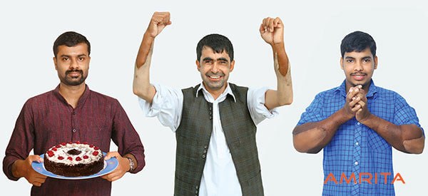 India's first double forearm transplant at AIMS